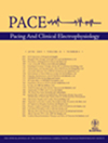 PACE-PACING AND CLINICAL ELECTROPHYSIOLOGY杂志封面